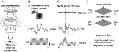 Comparing Ocular Responses to Caloric Irrigation and Electrical Vestibular Stimulation in Vestibular Schwannoma